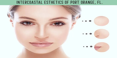 Say Goodbye to Wrinkles in Port Orange, FL with Intercoastal Esthetics